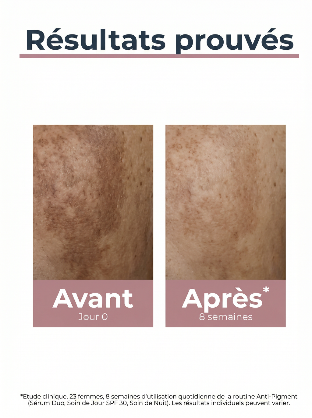 EUCERIN ANTI-PIGMENT SOIN DE JOUR SPF 30 - 50 ML